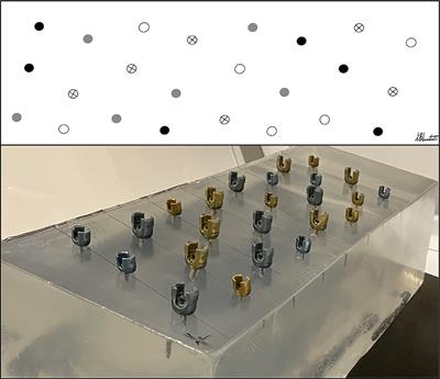 Quantification of metallic artifact on CT associated with titanium pedicle screws